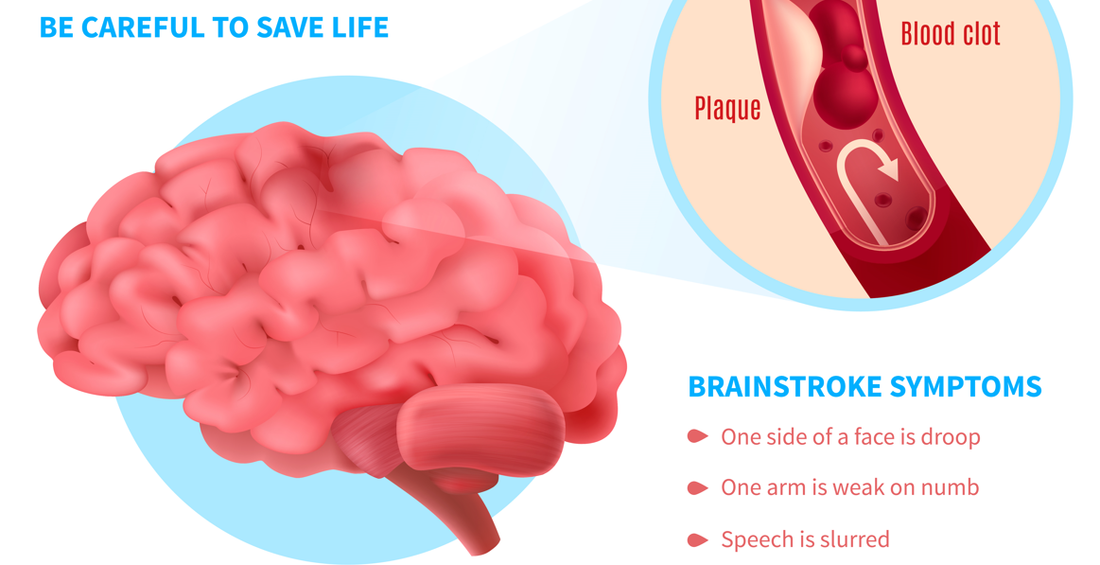 Breaking Down the Blood-Brain Barrier: Implications for Neurological Disorders