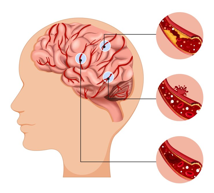 Decoding the Science Behind Chronic Pain Syndromes