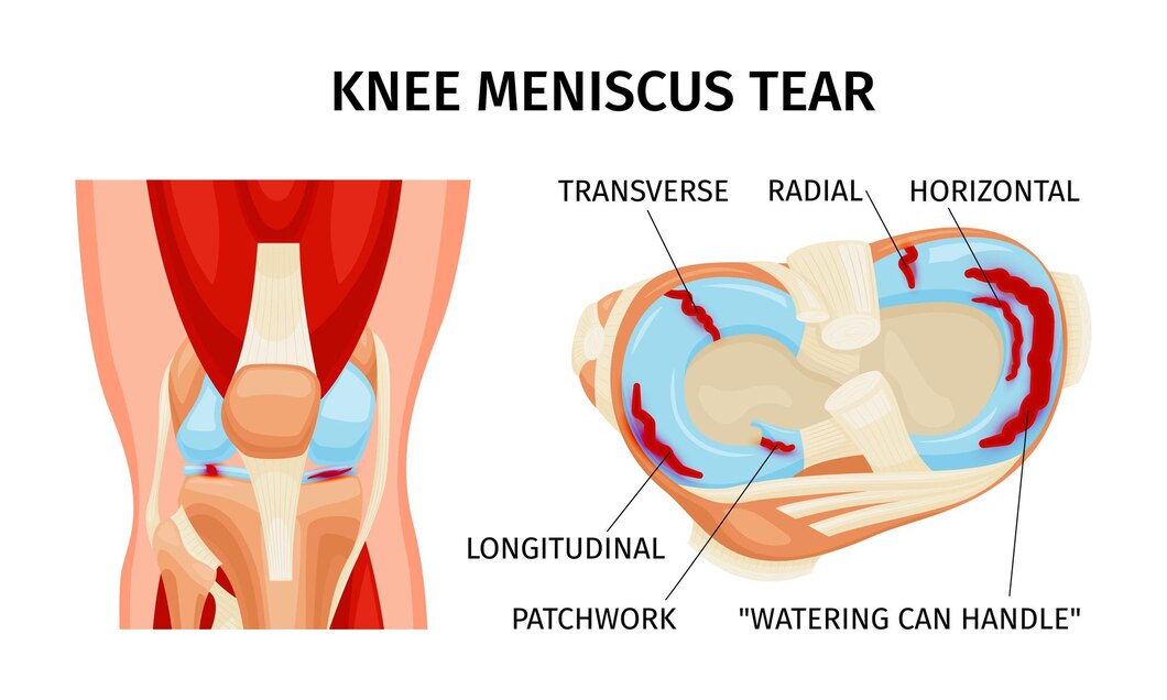 Exploring the Role of Collagen in Joint Health