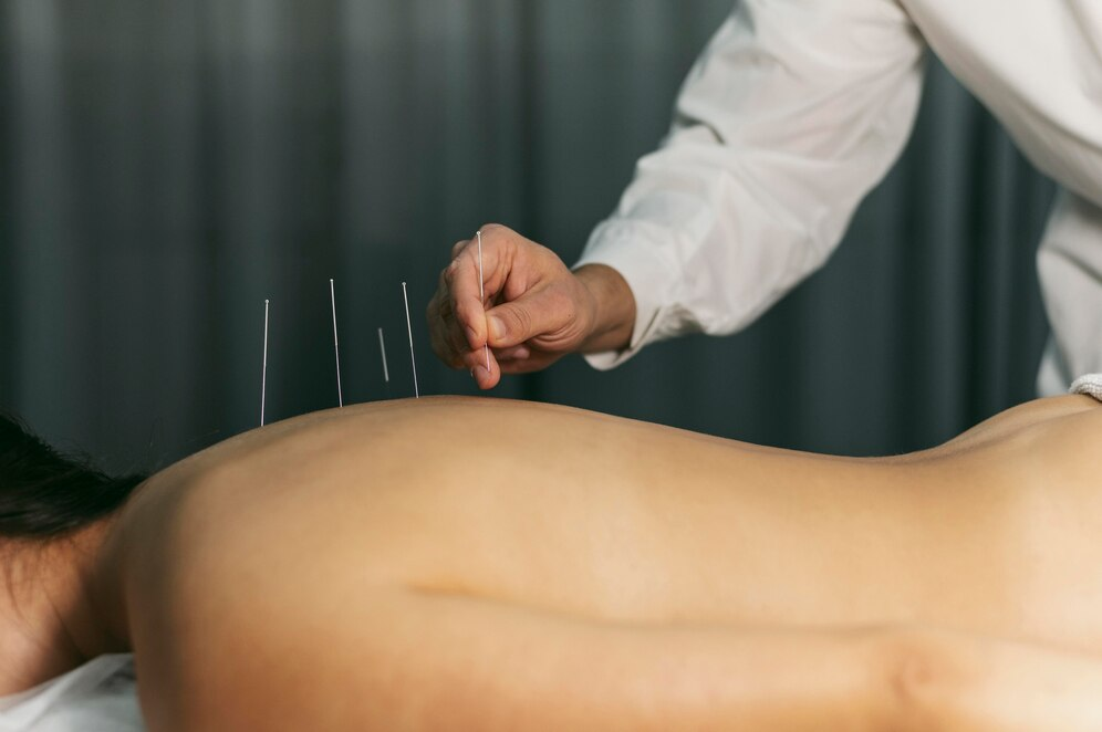 The Status of Acupuncture in Modern Pain Treatment