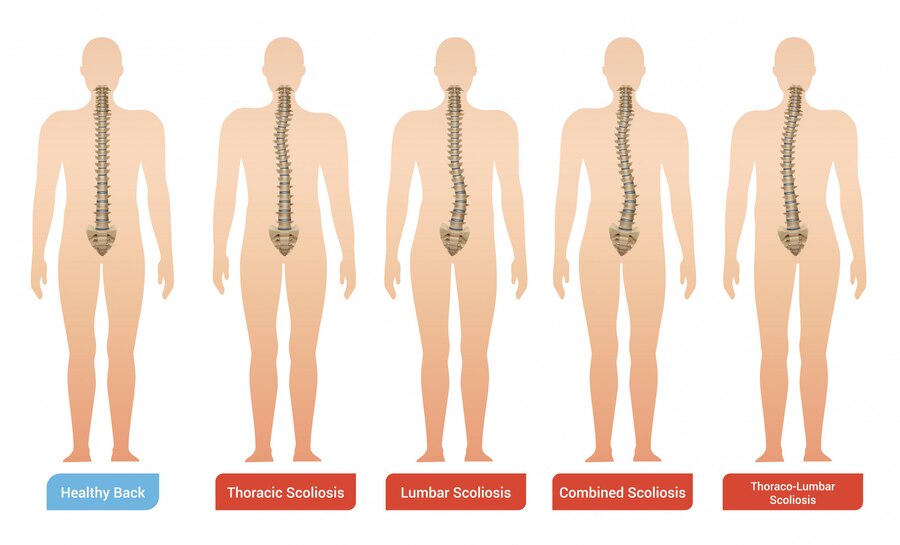 Understanding the Pain Pathways: How Pain Signals Are Transmitted